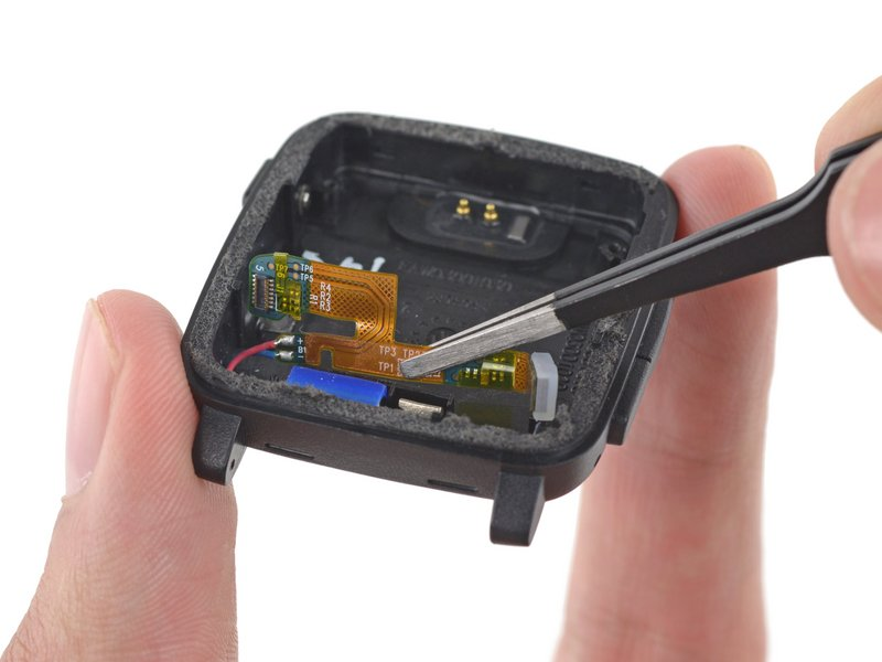 Imagem: Remoção do motor vibratório e do cabo flex do interior do corpo com auxílio de uma pinça.